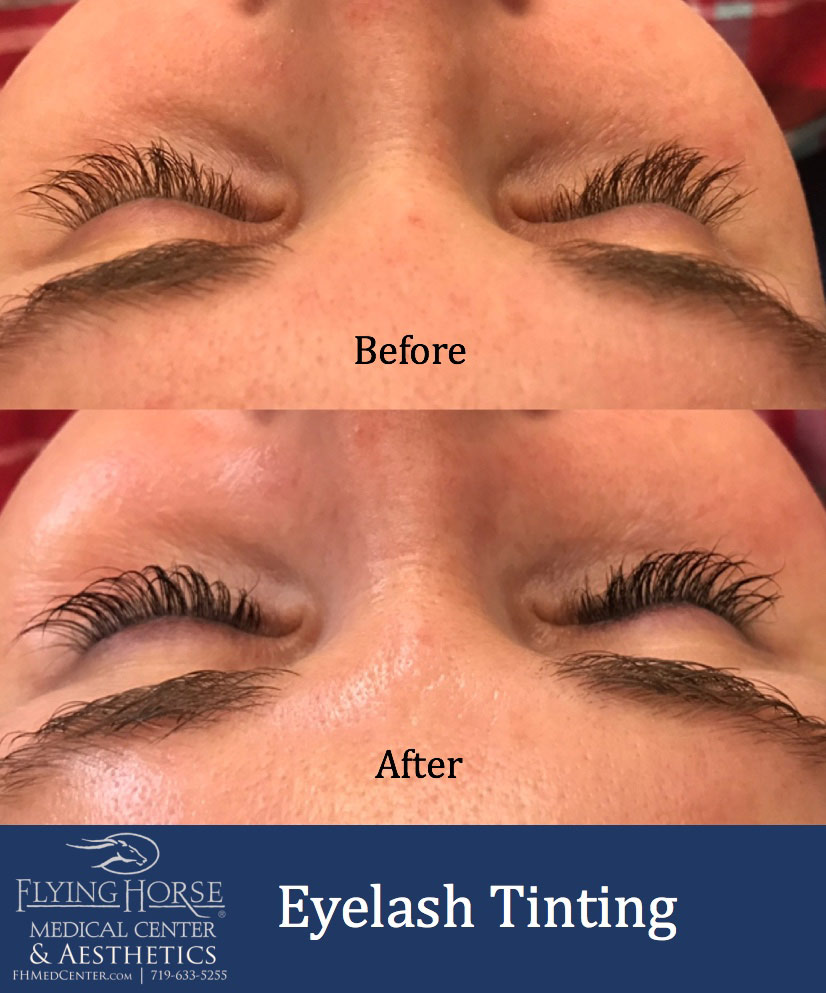 Additional Aesthetic Services-Eyelash tinting Services-Flying Horse Medical CenterFHMC Eyelash Tinting Additional Services