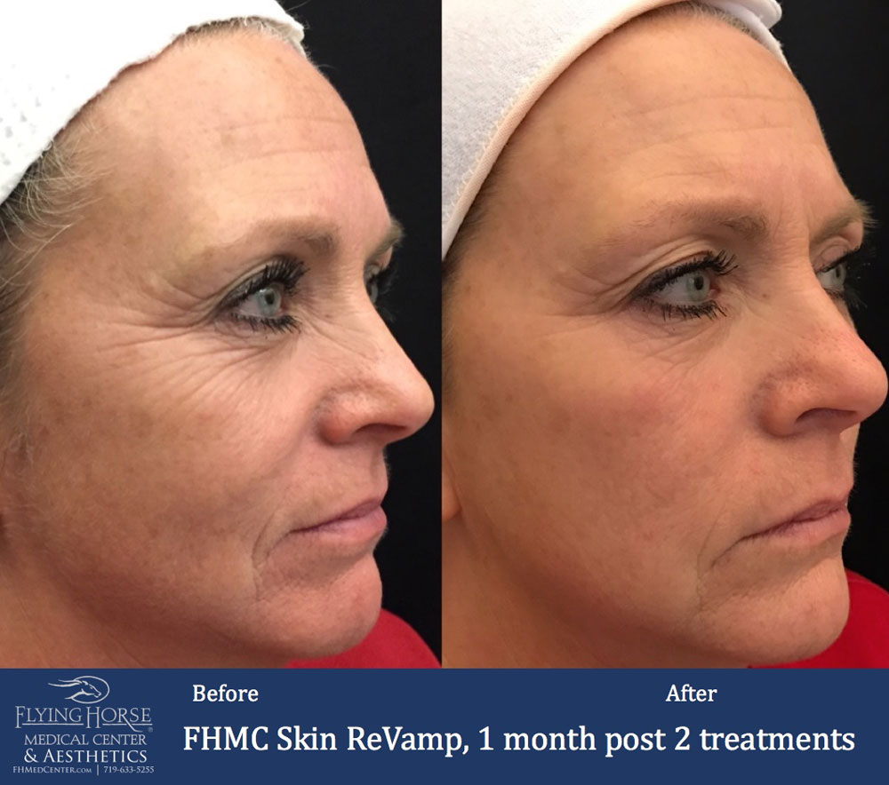 FHMC Skin ReVamp Front Services