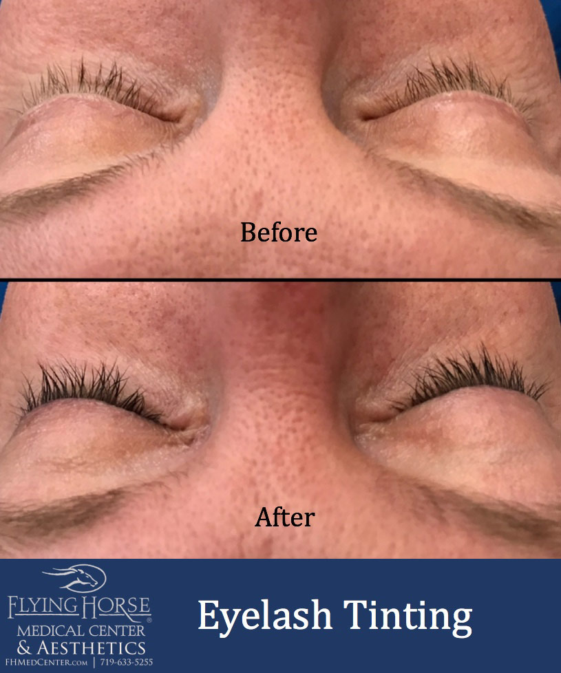 Additional Aesthetic Services-Eyelash tinting Services-Flying Horse Medical CenterFHMC Eyelash Tinting Services