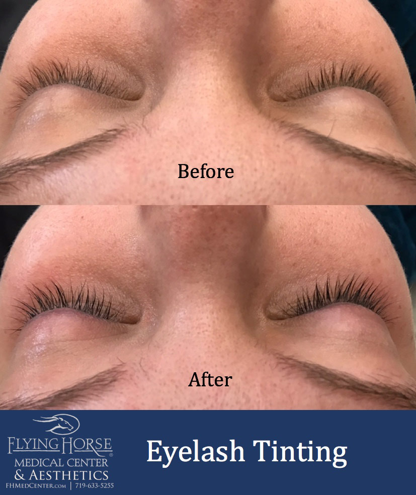 Additional Aesthetic Services-Eyelash tinting Services-Flying Horse Medical Center