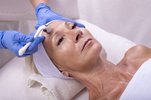 FHMC Microneedling Services Colorado Springs