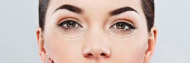 BLEPHAROPLASTY (LOWER) - Plastic Surgery