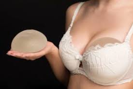 BREAST IMPLANT EXCHANGE - Plastic Surgery