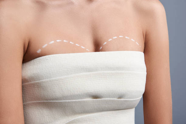 Breast Augmentation with Breast Lift -Plastic Surgery Flying Horse Medical Center